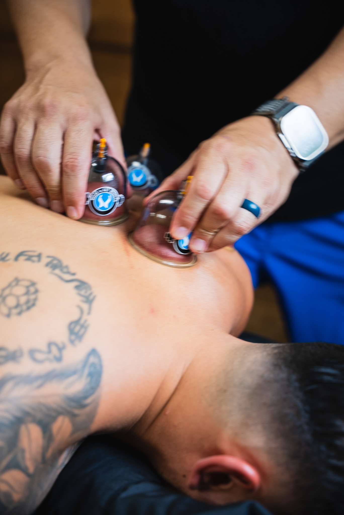 Who Cupping Is Best For